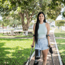 Latino woman with prosthetic leg standing with crutches under trees enjoying time outside.